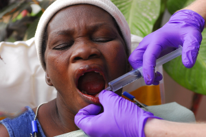 Eine Frau erhält einen oralen Impfstoff, der von einem Arzt in lila Handschuhen mit einer Spritze verabreicht wird.