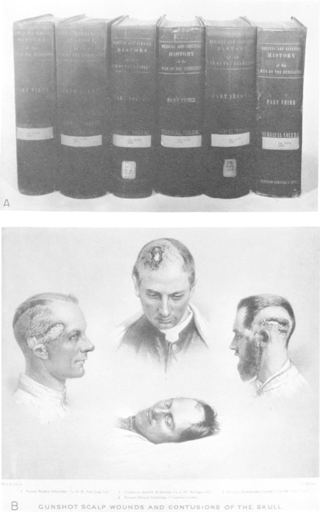 Ein Schwarz-Weiß-Foto eines Mannes mit einer Waffe, umgeben von Büchern, mit dem Text "Schussverletzungen am Schädel und Contusionen des Schädels" unten.